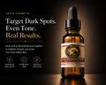 KoJic Acid & Niacinamide Dark Spot Serum
